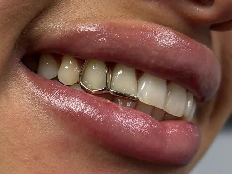 Silver girl grillz tooth cap